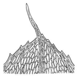 Rosulabryum billardierei, leaf apex. Drawn from holotype, Billardière, G-Hedwig-Schwägrichen.
 Image: R.C. Wagstaff © Landcare Research 2015 